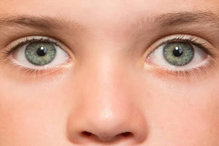 Rod and Cone Dystrophy: Understanding Your Specific Diagnosis